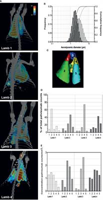 Pulmonary Deposition of Radionucleotide-Labeled Palivizumab: Proof-of-Concept Study